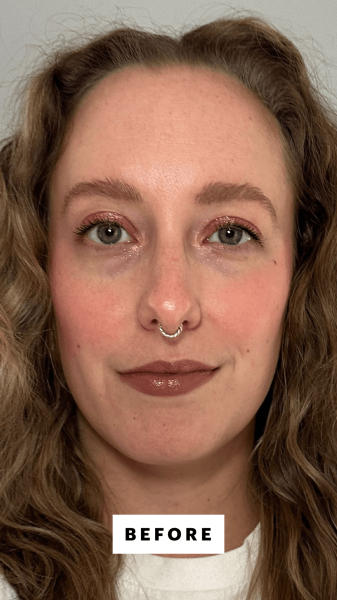 McGrath before applying the Ncessaire The Scalp Serum