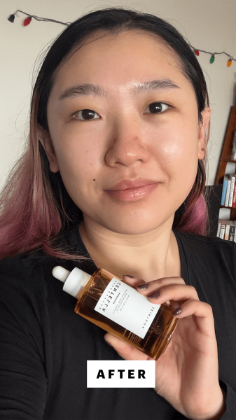 Han after applying the Skin1004 Madagascar Centella Ampoule